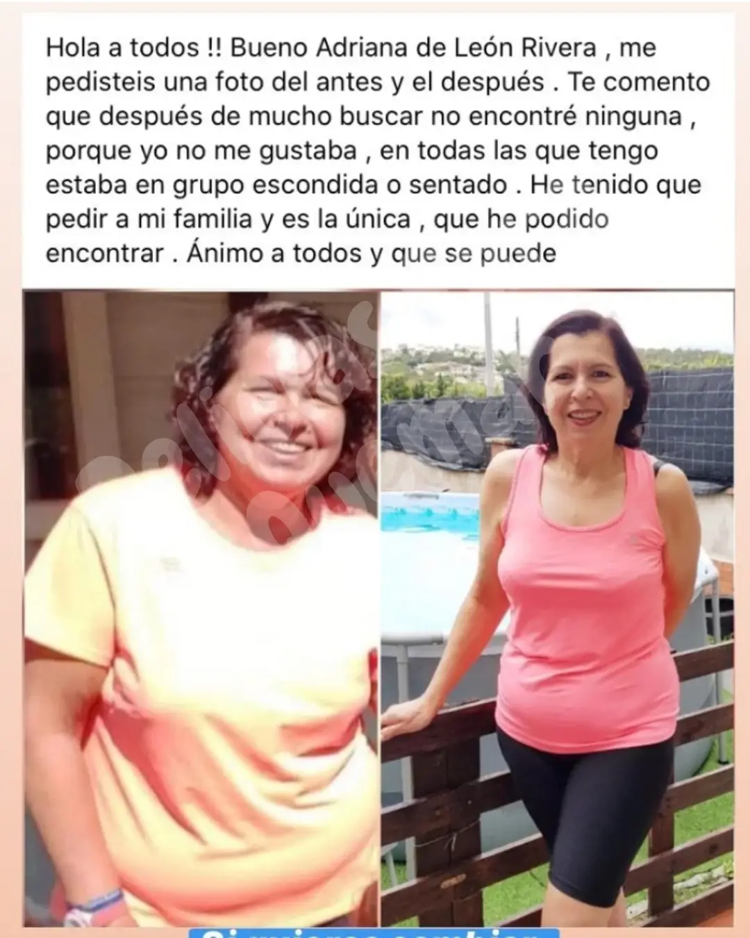 Depilacao-Express-11-1.webp