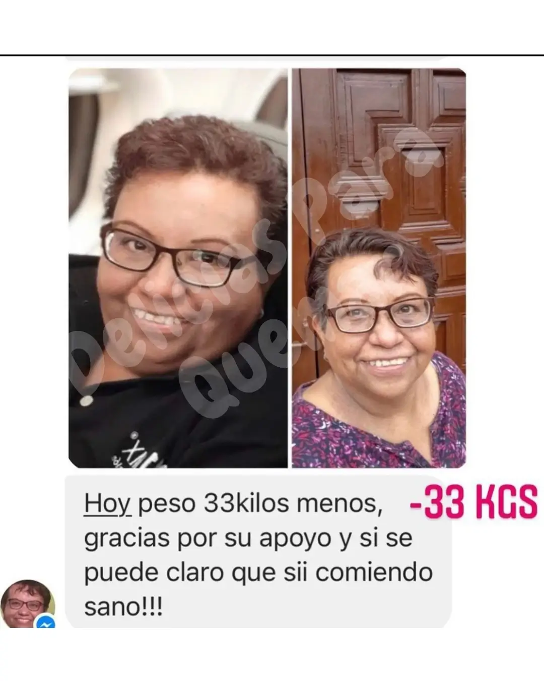 Depilacao-Express-4-1.webp